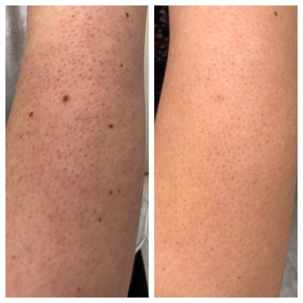 Transforming Body Lotion - Кислотный лосьон для тела